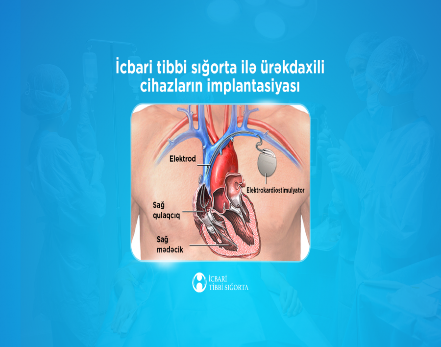 İcbari tibbi sığorta ilə qarşılanan aritmiyaların cərrahi müalicəsində beynəlxalq sertifikatlı cihazlardan istifadə olunur